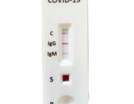 Covid-19 serologische tests