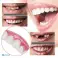 Augšējo zobu kosmētiskais pārklājums - Perfect Smile Vene attēls 1