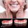 Augšējo zobu kosmētiskais pārklājums - Perfect Smile Vene attēls 2