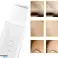 AG207F Appareil de peeling par ultrasons. photo 4