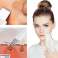 AG207E KAWITAC PEELING MASKINE. billede 5